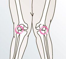 valgus.jpg valgus.jpg